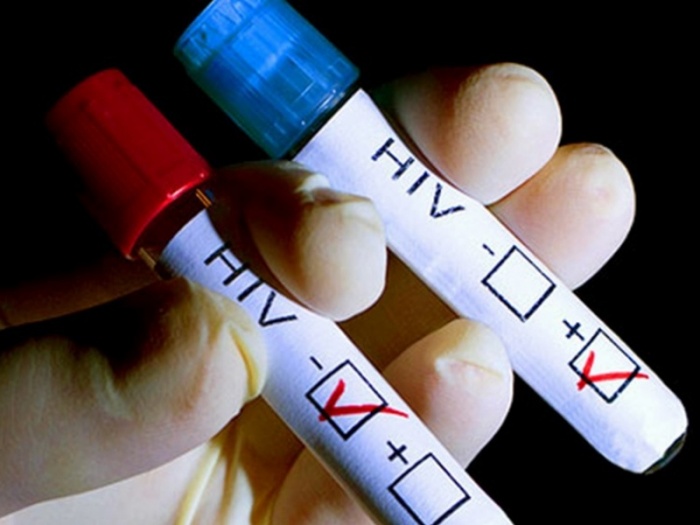Министерство здравоохранения планирует создать единый реестр больных ВИЧ и СПИДом